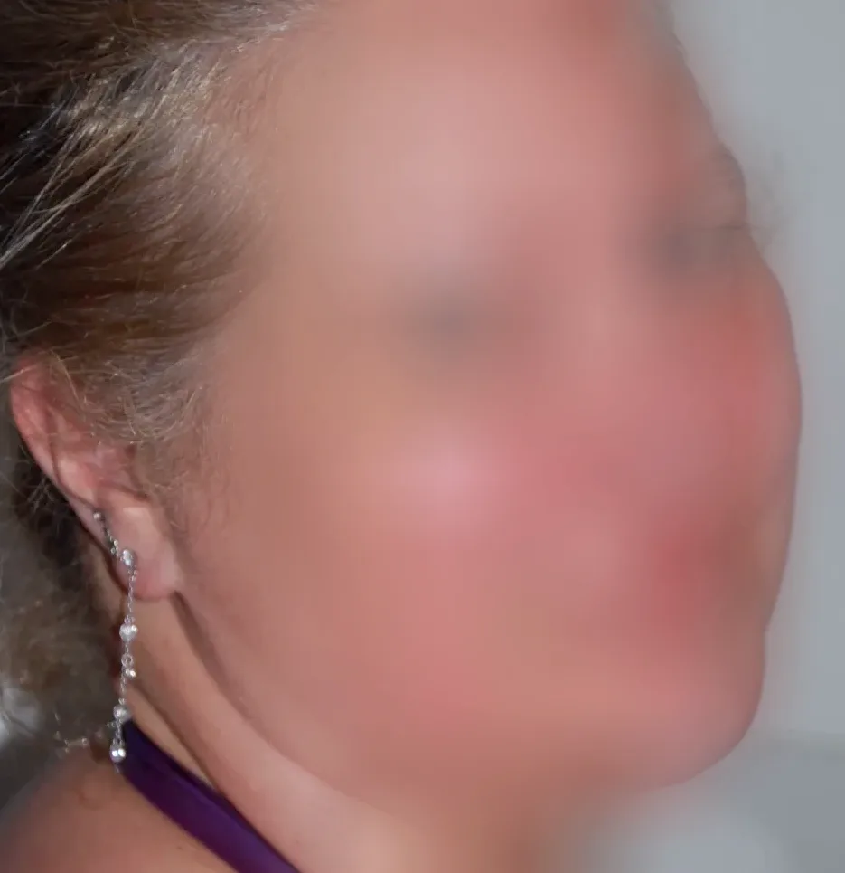 Michelle, 28